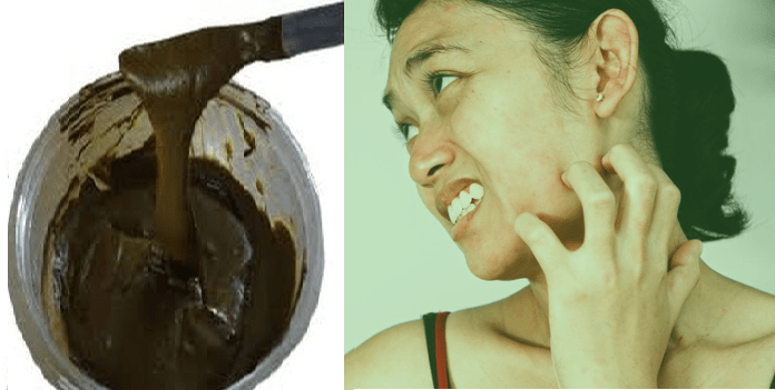 Side Effects of Mehndi (Heena)