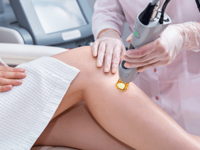 Laser hair Removal – Its Benefits and Precautions